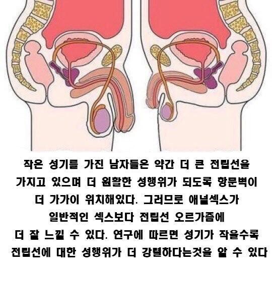 시디섭의전립선.jpg